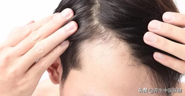 公认“天然黑发王”,不是桑葚,不是黑芝麻,生黑发增发量显年轻(图2) 公认“天然黑发王”,不是桑葚,不是黑芝麻,生黑发增发量显年轻(图2)