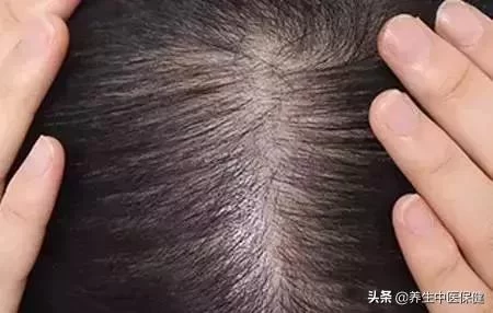 公认“天然黑发王”,不是桑葚,不是黑芝麻,生黑发增发量显年轻(图4) 公认“天然黑发王”,不是桑葚,不是黑芝麻,生黑发增发量显年轻(图4)